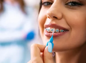 How To Adjust To Wearing Invisalign Braces